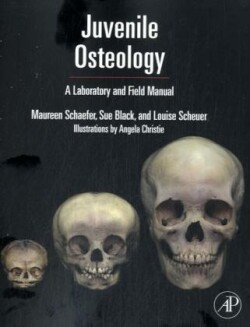 Juvenile Osteology