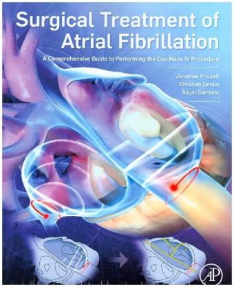 Surgical Treatment of Atrial Fibrillation