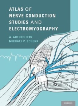 Atlas of Nerve Conduction Studies and Electromyography