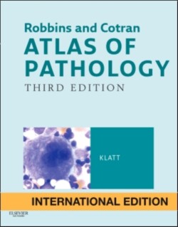 Robbins & Cotran Atlas of Pathology