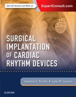 Surgical Implantation of Cardiac Rhythm Devices