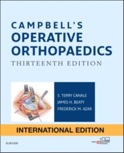 Campbell's Operative Orthopaedics