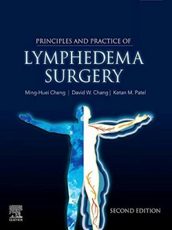 Principles and Practice of Lymphedema Surgery