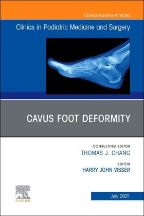 Cavus Foot Deformity, An Issue of Clinics in Podiatric Medicine and Surgery