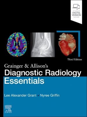 Grainger & Allison's Diagnostic Radiology Essentials