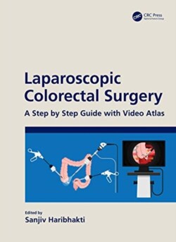 Laparoscopic Colorectal Surgery