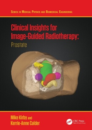 Clinical Insights for Image-Guided Radiotherapy