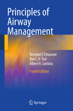 Principles of Airway Management
