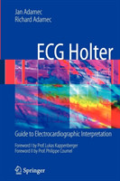 ECG Holter