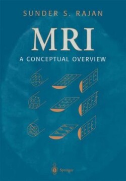 MRI