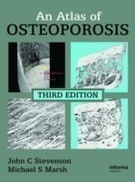 Atlas of Osteoporosis