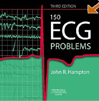150 ECG Problems