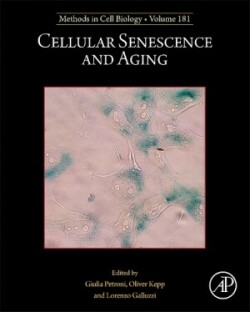 Cellular Senescence and Aging