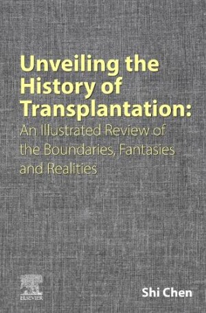 Unveiling the History of Transplantation