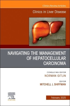 Navigating the Management of Hepatocellular Carcinoma, An Issue of Clinics in Liver Disease