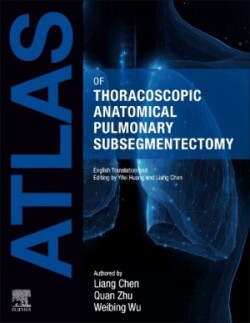 Atlas of Thoracoscopic Anatomical Pulmonary Subsegmentectomy