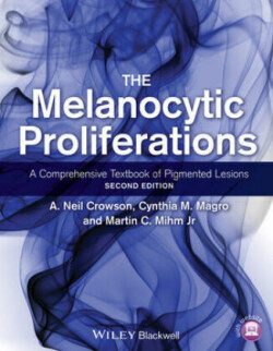 Melanocytic Proliferations