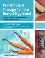 Peri–Implant Therapy for the Dental Hygienist – Clinical Guide to Maintenance and Disease Complications