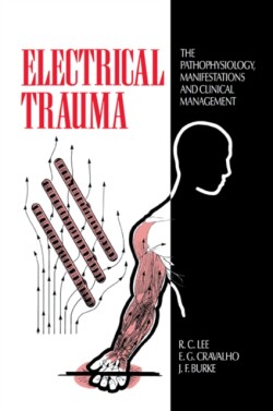 Electrical Trauma
