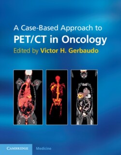 Case-Based Approach to PET/CT in Oncology