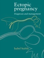 Ectopic Pregnancy