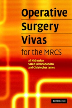 Operative Surgery Vivas for the MRCS