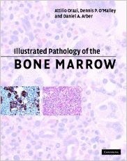 Illustrated Pathology of the Bone Marrow