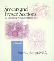 Smears and Frozen Sections in Surgical Neuropathology