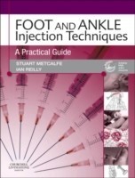 Foot and Ankle Injection Techniques