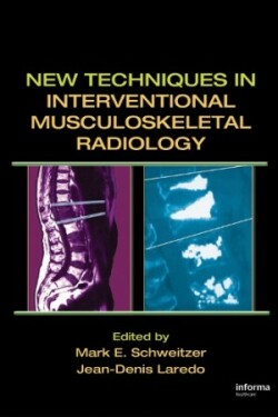 New Techniques in Interventional Musculoskeletal Radiology