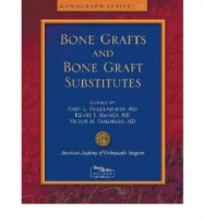 Bone Grafts and Bone Graft Substitutes