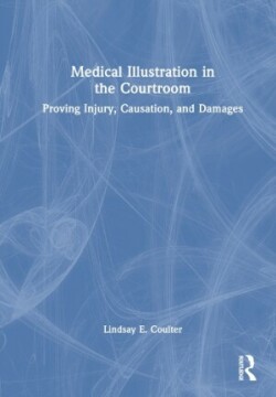 Medical Illustration in the Courtroom