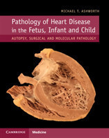 Pathology of Heart Disease in the Fetus, Infant and Child