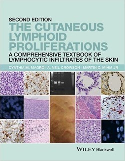 Cutaneous Lymphoid Proliferations