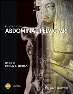 Abdominal–Pelvic MRI