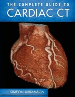 Complete Guide To Cardiac CT (PB)