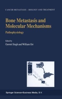 Bone Metastasis and Molecular Mechanisms