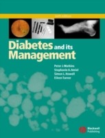 Diabetes and Its Management
