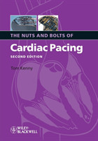 Nuts and Bolts of Cardiac Pacing