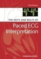 Nuts and bolts of Paced ECG Interpretation