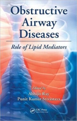 Obstructive Airway Diseases