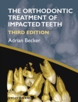 Orthodontic Treatment of Impacted Teeth