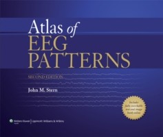 Atlas of EEG Patterns