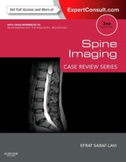 Spine Imaging: Case Review Series