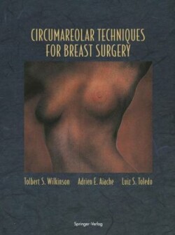 Circumareolar Techniques for Breast Surgery