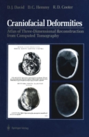 Craniofacial Deformities
