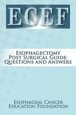 Esophagectomy Post Surgical Guide