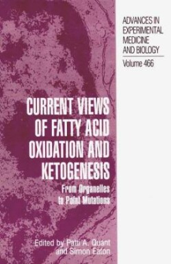 Current Views of Fatty Acid Oxidation and Ketogenesis