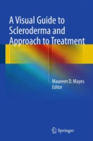 Visual Guide to Scleroderma and Approach to Treatment