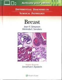 Differential Diagnoses in Surgical Pathology: Breast